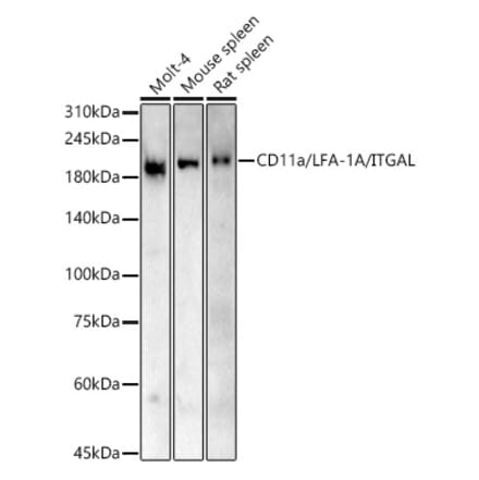 Western Blot - Anti-CD11a Antibody (A13570) - Antibodies.com