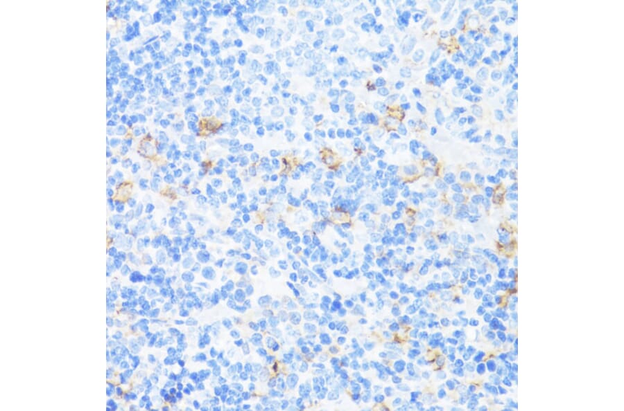 Immunohistochemistry - Anti-CD11a Antibody (A13570) - Antibodies.com