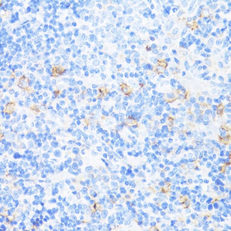 Immunohistochemistry - Anti-CD11a Antibody (A13570) - Antibodies.com