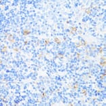 Immunohistochemistry - Anti-CD11a Antibody (A13570) - Antibodies.com