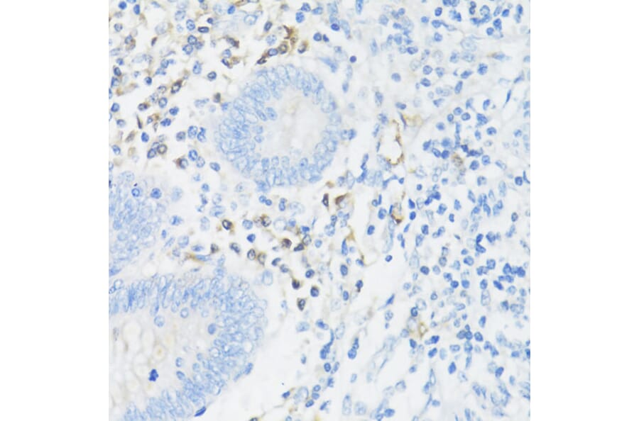Immunohistochemistry - Anti-CD11a Antibody (A13570) - Antibodies.com