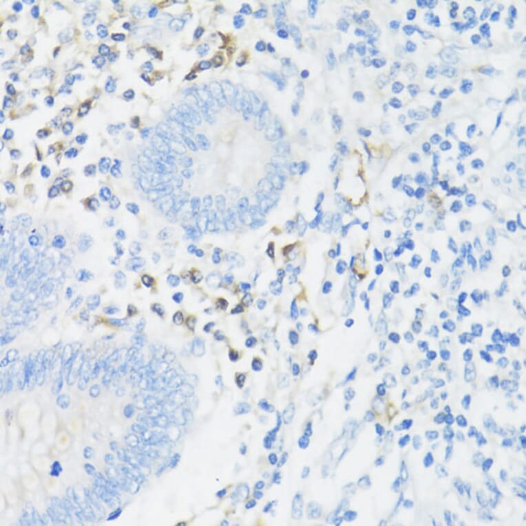 Immunohistochemistry - Anti-CD11a Antibody (A13570) - Antibodies.com