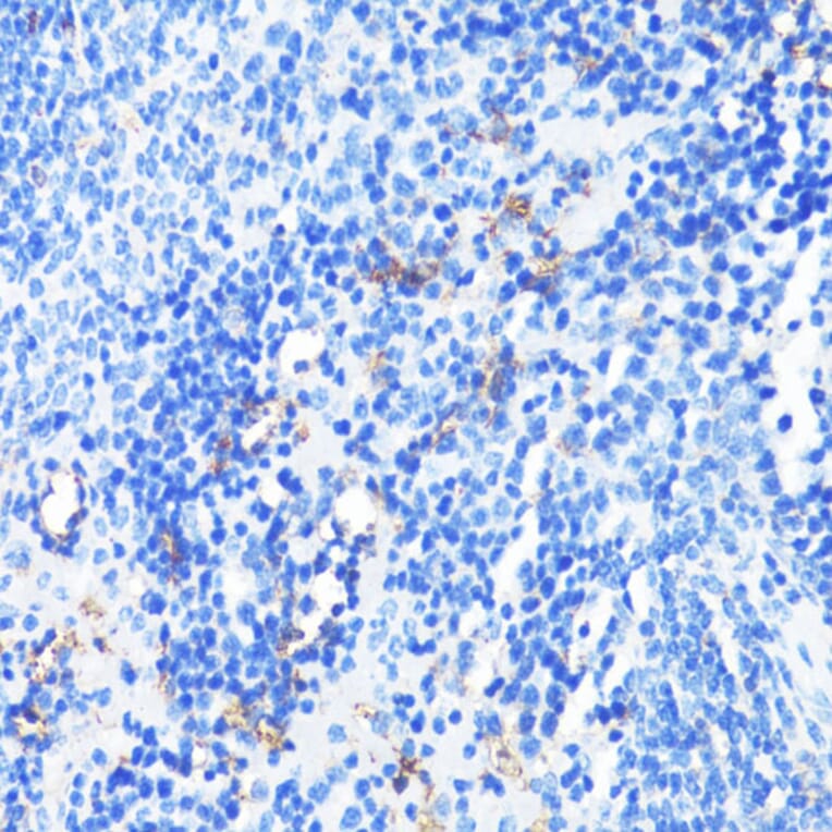 Immunohistochemistry - Anti-CD11a Antibody (A13570) - Antibodies.com