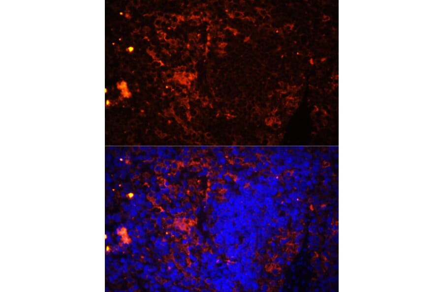 Immunofluorescence - Anti-CD11a Antibody (A13570) - Antibodies.com