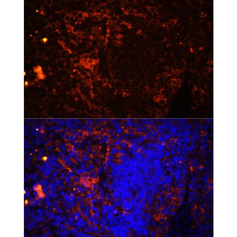 Immunofluorescence - Anti-CD11a Antibody (A13570) - Antibodies.com