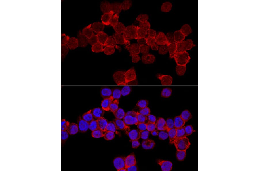 Immunofluorescence - Anti-CD11a Antibody (A13570) - Antibodies.com