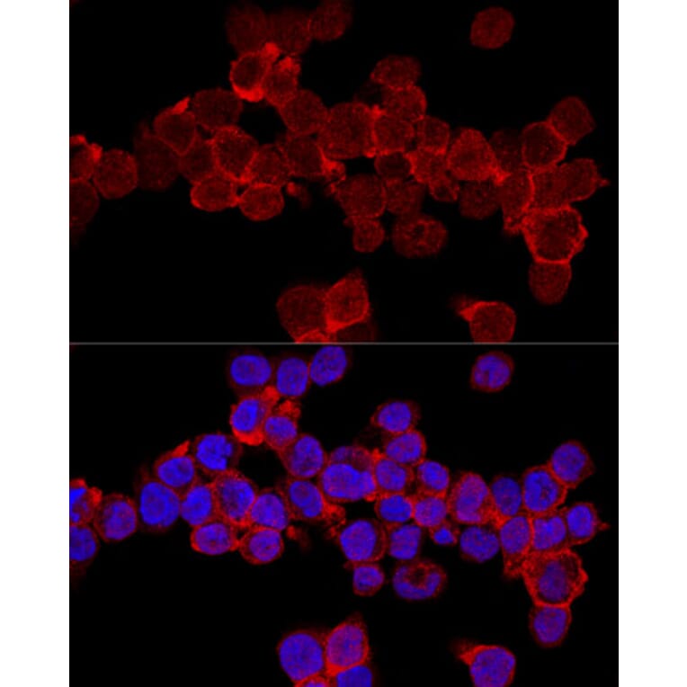 Immunofluorescence - Anti-CD11a Antibody (A13570) - Antibodies.com