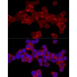 Immunofluorescence - Anti-CD11a Antibody (A13570) - Antibodies.com