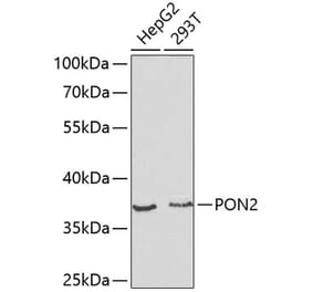Western Blot - Anti-PON2 Antibody (A13571) - Antibodies.com