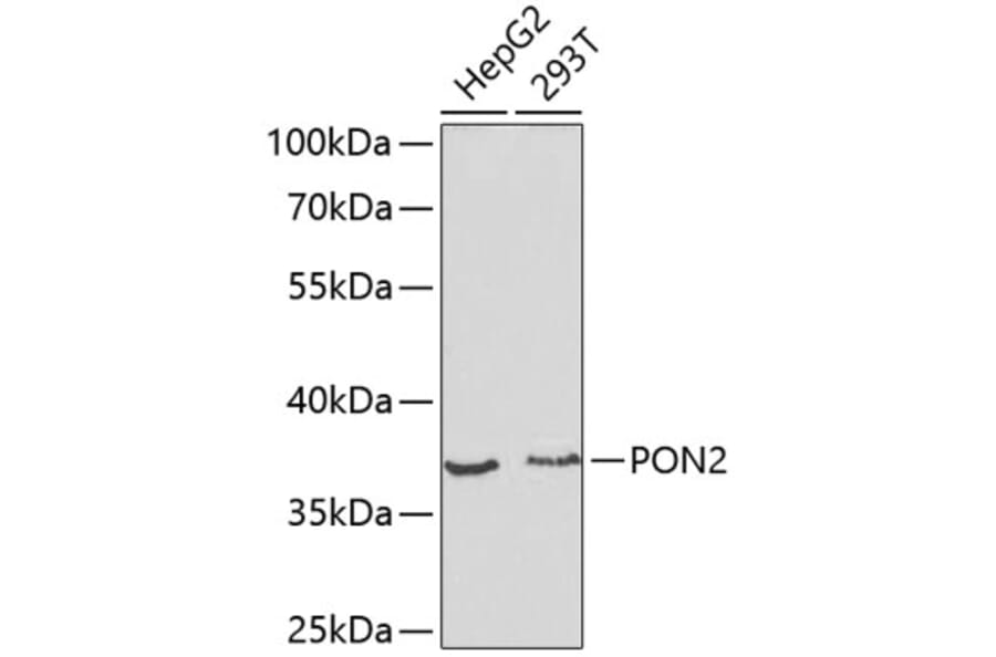 Western Blot - Anti-PON2 Antibody (A13571) - Antibodies.com