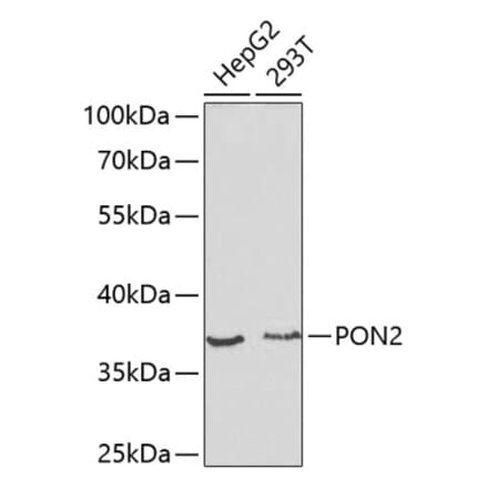 Western Blot - Anti-PON2 Antibody (A13571) - Antibodies.com