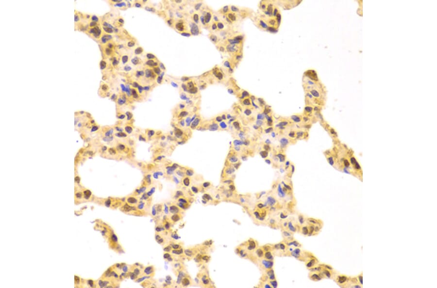 Immunohistochemistry - Anti-SRSF1 Antibody (A1649) - Antibodies.com
