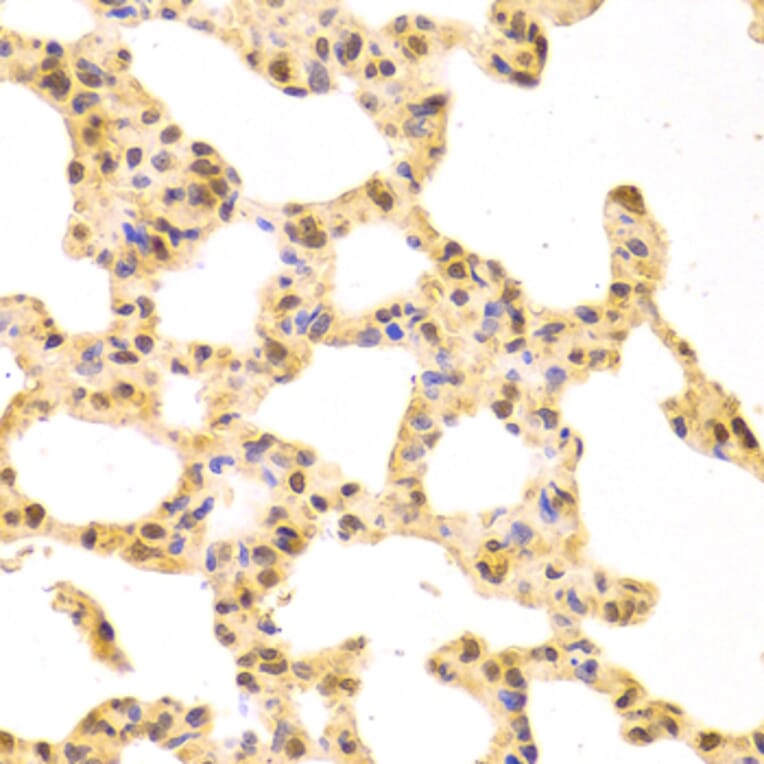 Immunohistochemistry - Anti-SRSF1 Antibody (A1649) - Antibodies.com