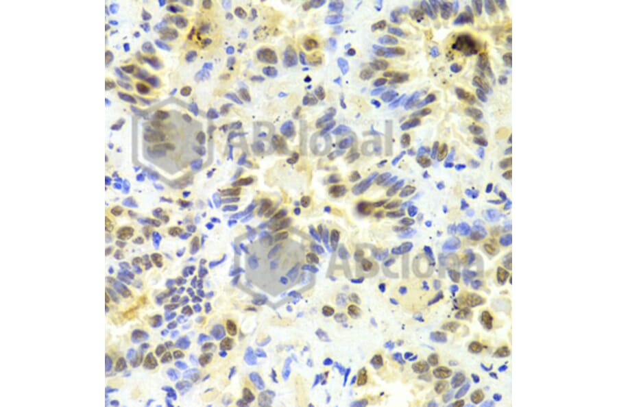 Immunohistochemistry - Anti-SRSF1 Antibody (A1649) - Antibodies.com