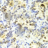 Immunohistochemistry - Anti-SRSF1 Antibody (A1649) - Antibodies.com