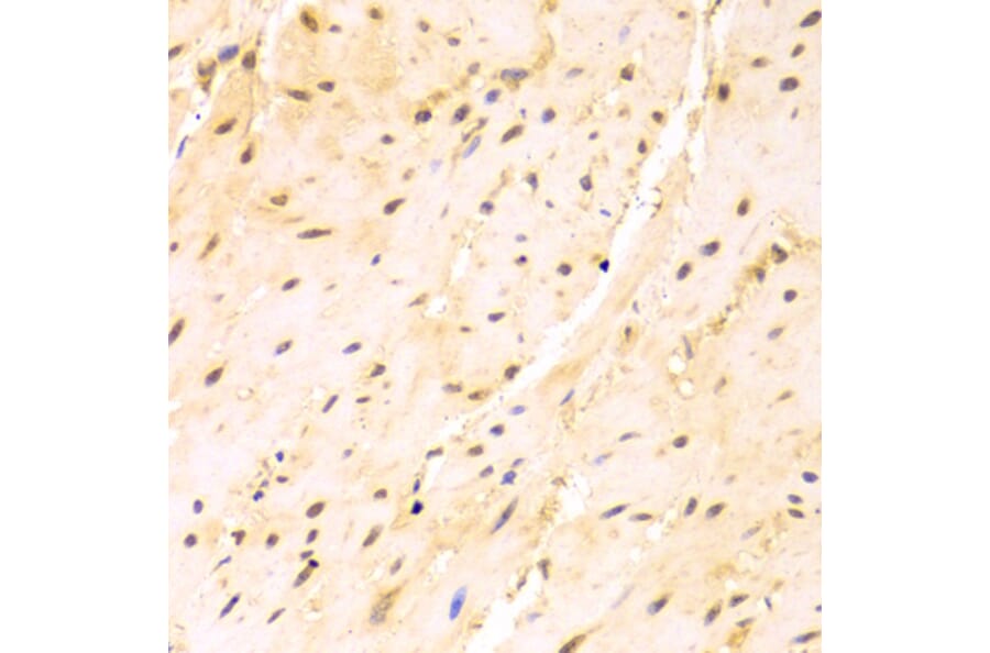 Immunohistochemistry - Anti-SRSF1 Antibody (A1649) - Antibodies.com