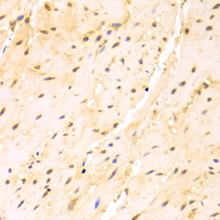 Immunohistochemistry - Anti-SRSF1 Antibody (A1649) - Antibodies.com