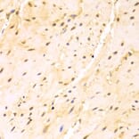 Immunohistochemistry - Anti-SRSF1 Antibody (A1649) - Antibodies.com