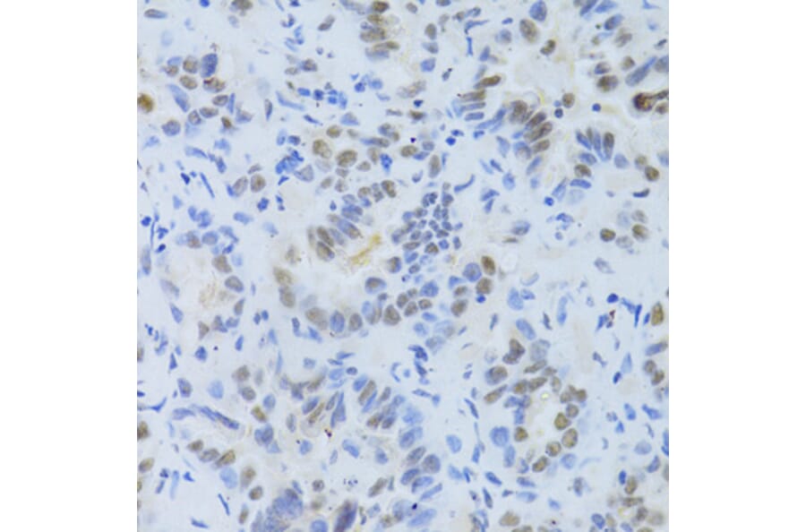 Immunohistochemistry - Anti-SRSF1 Antibody (A1649) - Antibodies.com