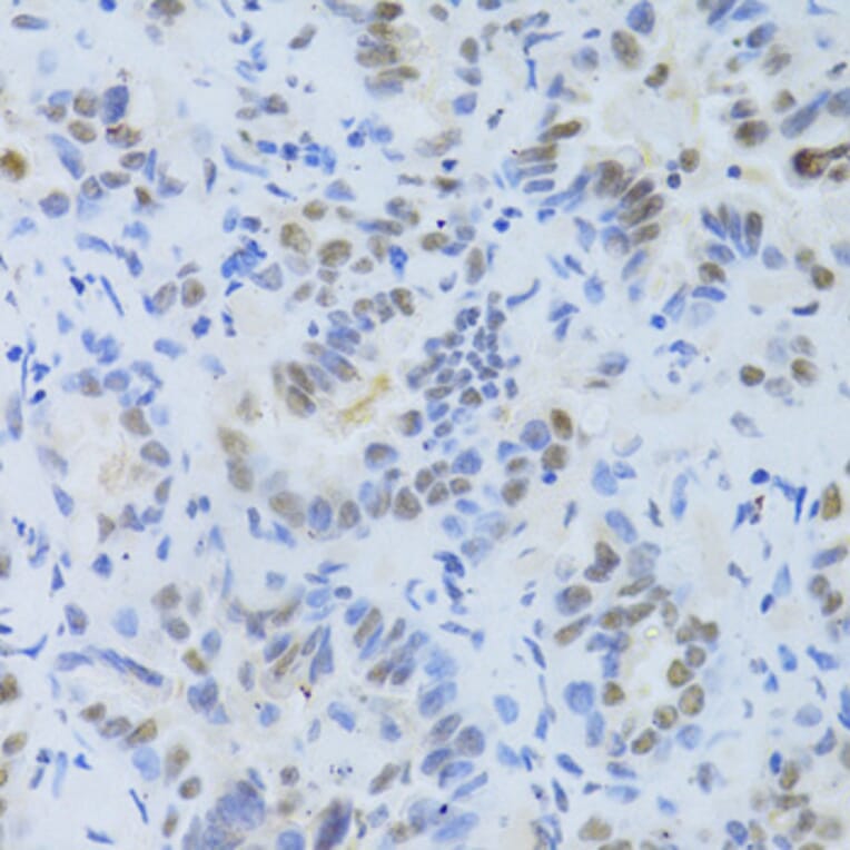 Immunohistochemistry - Anti-SRSF1 Antibody (A1649) - Antibodies.com