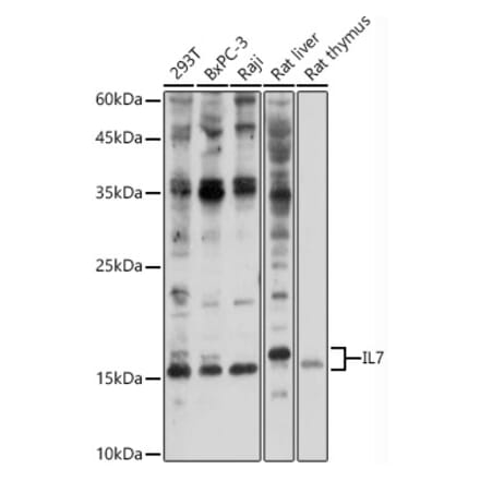 Western Blot - Anti-IL-7 Antibody (A13573) - Antibodies.com