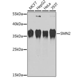 Western Blot - Anti-SMN/Gemin 1 Antibody (A13574) - Antibodies.com