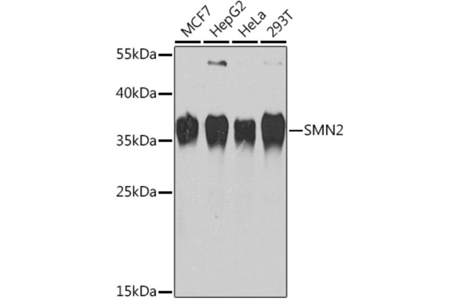 Western Blot - Anti-SMN/Gemin 1 Antibody (A13574) - Antibodies.com
