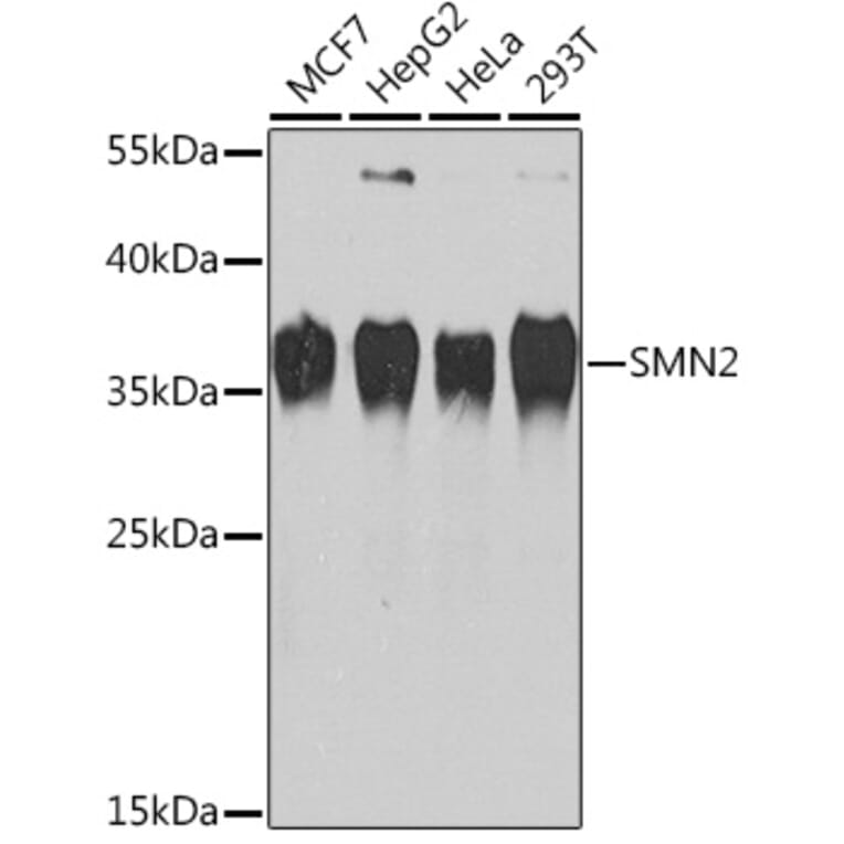 Western Blot - Anti-SMN/Gemin 1 Antibody (A13574) - Antibodies.com
