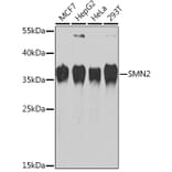Western Blot - Anti-SMN/Gemin 1 Antibody (A13574) - Antibodies.com