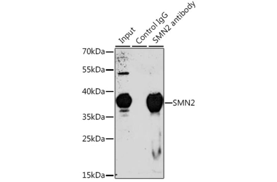 Western Blot - Anti-SMN/Gemin 1 Antibody (A13574) - Antibodies.com
