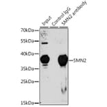 Western Blot - Anti-SMN/Gemin 1 Antibody (A13574) - Antibodies.com