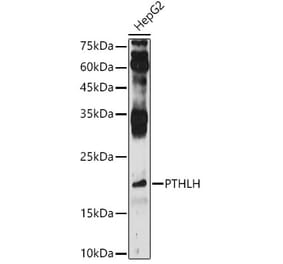 Western Blot - Anti-PTHLH Antibody (A13575) - Antibodies.com