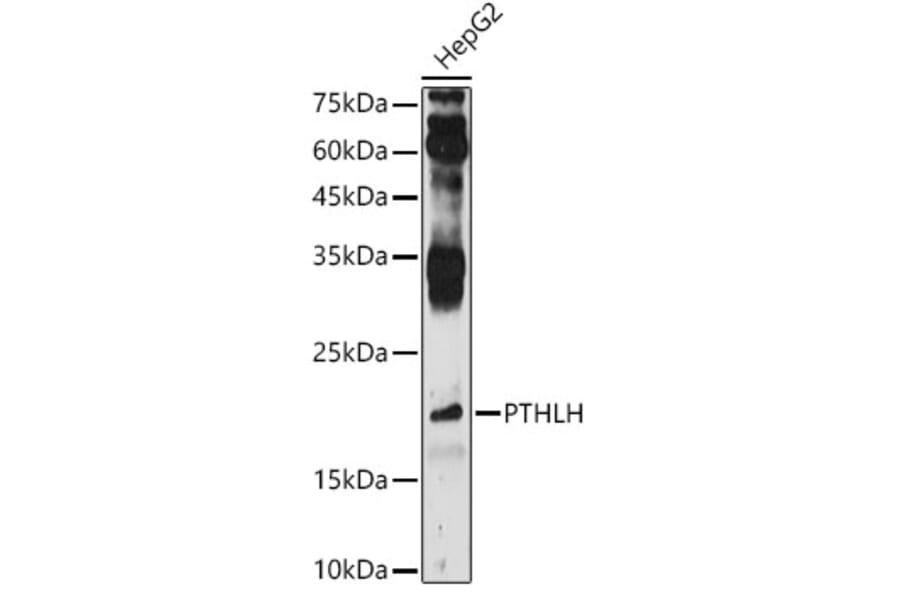 Western Blot - Anti-PTHLH Antibody (A13575) - Antibodies.com