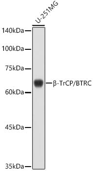 Western blot analysis of extracts of various cell lines, using Anti-BTRC Antibody (A1656) at 1:1,000 dilution.
Secondary antibody: Goat Anti-Rabbit IgG (H+L) (HRP) (AS014) at 1:10,000 dilution.
Lysates / proteins: 25µg per lane.
Blocking buffer: 3% non-fat dry milk in TBST.
Detection: ECL Basic Kit (RM00020).
Exposure time: 60s.