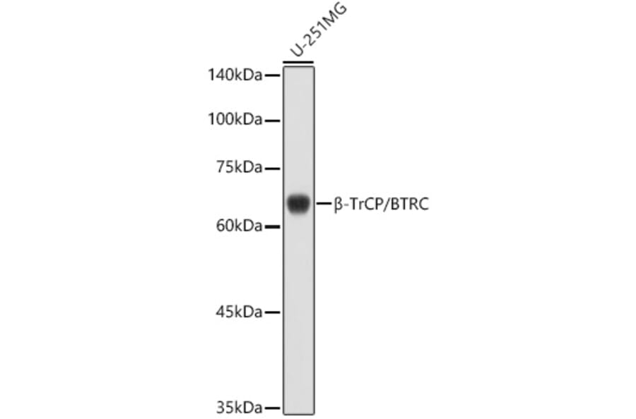 Western Blot - Anti-Beta TRCP/HOS Antibody (A13576) - Antibodies.com