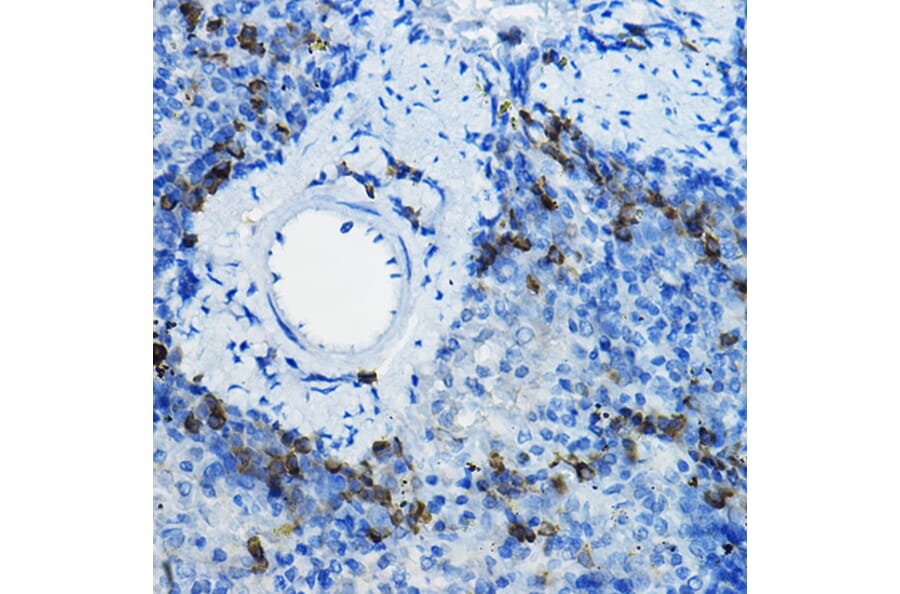 Immunohistochemistry - Anti-Beta TRCP/HOS Antibody (A13576) - Antibodies.com
