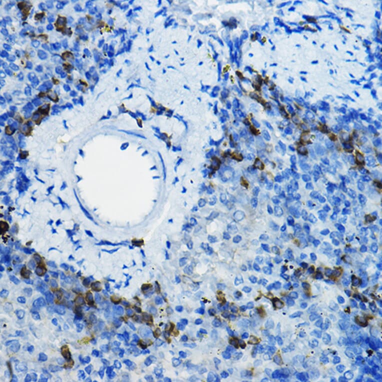 Immunohistochemistry - Anti-Beta TRCP/HOS Antibody (A13576) - Antibodies.com