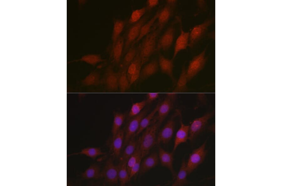 Immunofluorescence - Anti-Beta TRCP/HOS Antibody (A13576) - Antibodies.com