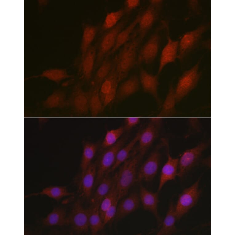 Immunofluorescence - Anti-Beta TRCP/HOS Antibody (A13576) - Antibodies.com