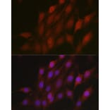 Immunofluorescence - Anti-Beta TRCP/HOS Antibody (A13576) - Antibodies.com