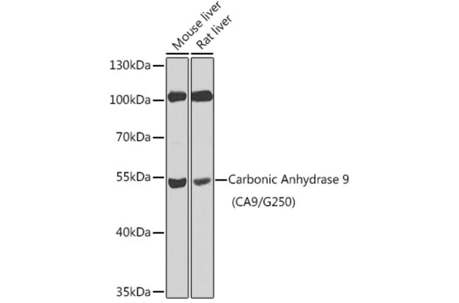 Western Blot - Anti-Carbonic Anhydrase 9/CA9 Antibody (A13577) - Antibodies.com