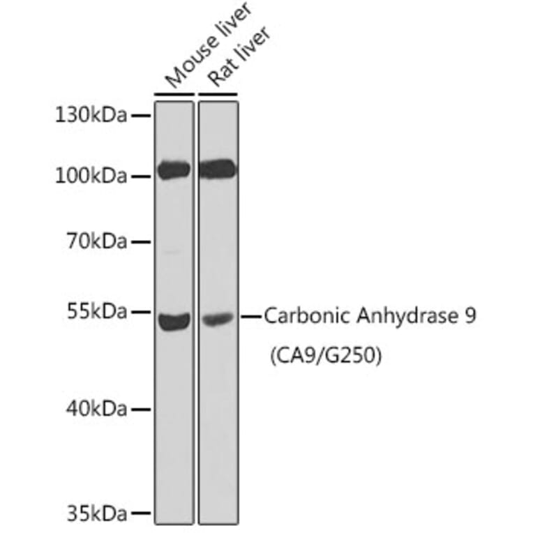 Western Blot - Anti-Carbonic Anhydrase 9/CA9 Antibody (A13577) - Antibodies.com
