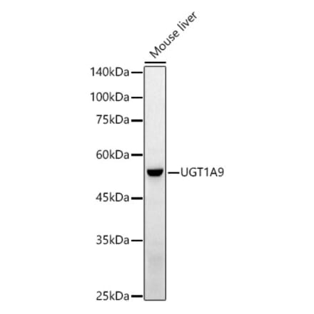Western Blot - Anti-UGT1A9 Antibody (A13579) - Antibodies.com