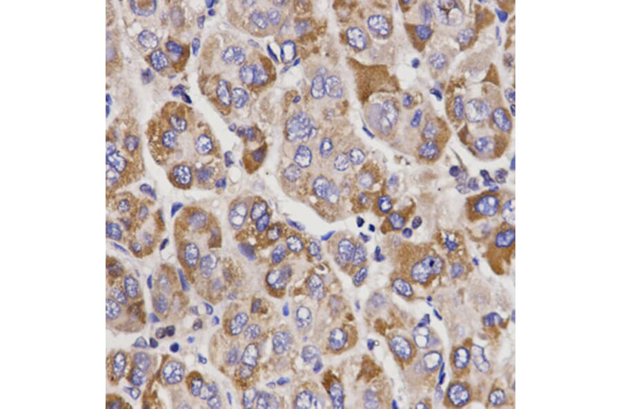 Immunohistochemistry - Anti-UGT1A9 Antibody (A13579) - Antibodies.com