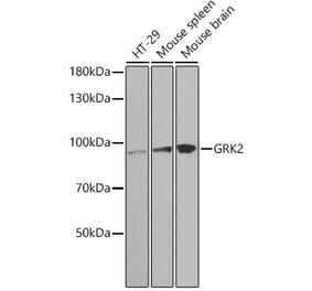 Western Blot - Anti-GRK2 Antibody (A13580) - Antibodies.com