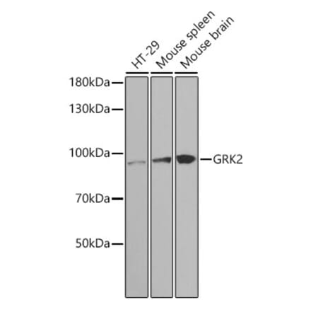 Western Blot - Anti-GRK2 Antibody (A13580) - Antibodies.com