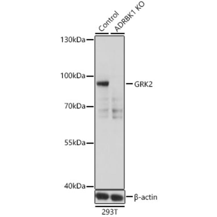 Western Blot - Anti-GRK2 Antibody (A13580) - Antibodies.com