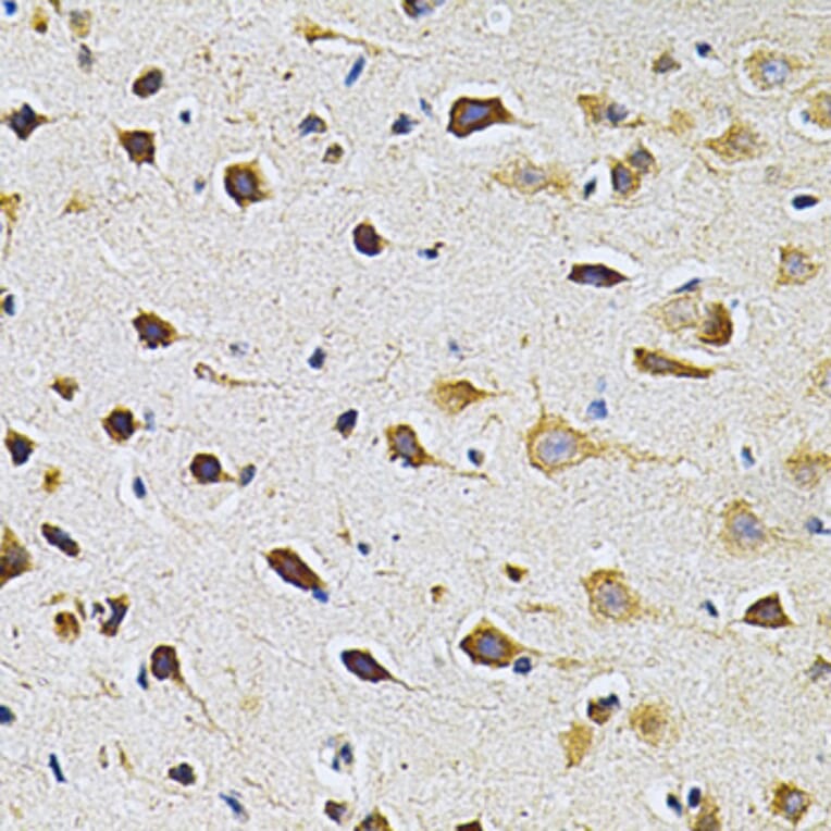 Immunohistochemistry - Anti-GRK2 Antibody (A13580) - Antibodies.com