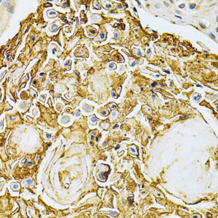 Immunohistochemistry - Anti-GRK2 Antibody (A13580) - Antibodies.com