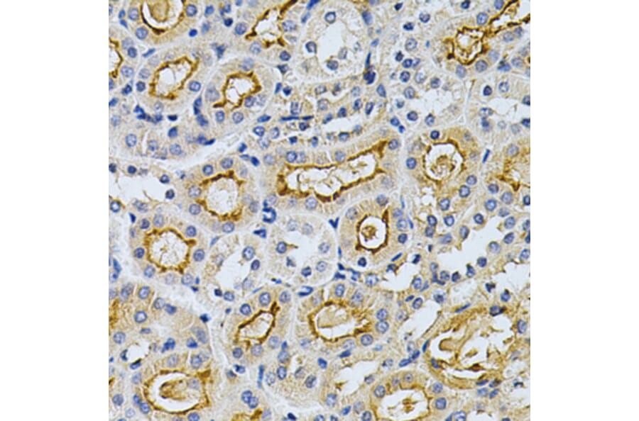 Immunohistochemistry - Anti-GRK2 Antibody (A13580) - Antibodies.com